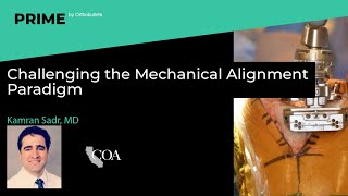 Challenging the Mechanical Alignment Paradigm - Kamran Sadr, MD