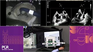 The EVOQUE and PASCAL Precision systems in action: simulation- and case-based learning