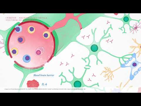 06 - Neuromyelitis