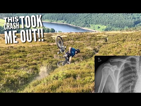 THE SILLY CRASH THAT BROKE MY SHOULDER! 🤦‍♂️😞