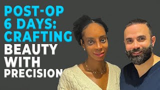 Post-Op 6 Days: Crafting Beauty with Precision | Ethnic Rhinoplasty by Dr. Bora Ok