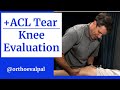 Knee Evaluation of Patient with an ACL Tear!