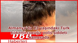 Almanya'da 13 yaşındaki Türk kökenli çocuğa polis şiddeti kamerada