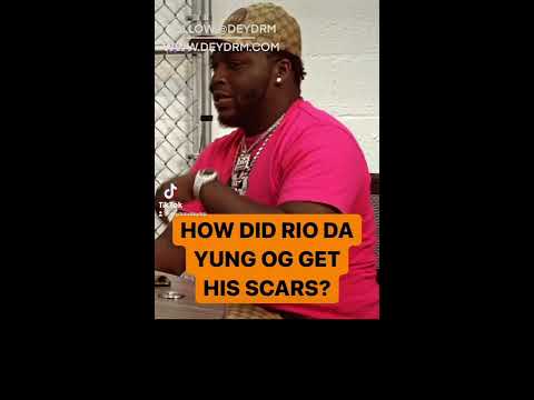 How Did Rio Da Yung Og Get His Scars? Pt 1 - YouTube