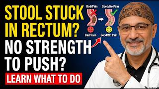 STOOL STUCK IN THE RECTUM! WHAT IS IT AND WHAT TO DO? | Doctor Explains | Senior Health