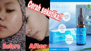 REVIEW SERUM TERMURAH!! Hanasui vitamin c   collagen✨