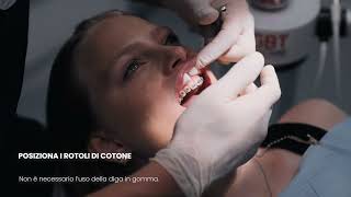 Curodont Repair - Application Around Orthodontic Brackets Italian