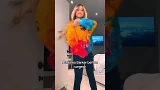 Famous ALABAMA BARKER BEFORE SURGERY! #music Wealth