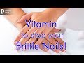 What Vitamin are you lacking when you have brittle nails? - Dr. Priya J Talageri