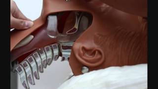 Intubation video of Ambu Intubation Trainer.wmv