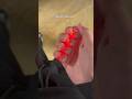 Para los come uñas 🥺…