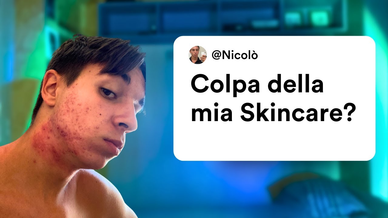 La tua Skincare fa venire i brufoli - YouTube