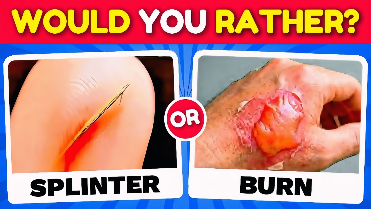 Would You Rather...? EXTREME Edition 🤔❓✅ HARDEST Choices Ever! 🔥 Quiz Duel
