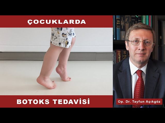 Çocuklarda Botoks Tedavisi - Op.Dr. Tayfun AÇIKGÖZ