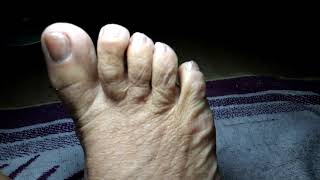 Tirando Esmalte Das Unhas Dos Pés.