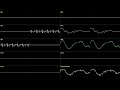 ○♪ Sonic 3 (Prototype) - Hydrocity Zone Act 1 [Oscilloscope View]
