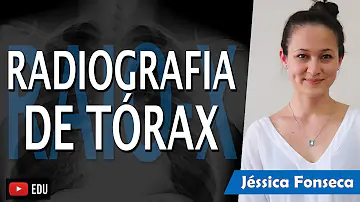 Como é chamado o método de radiografia do tórax criado pelo médico brasileiro Manuel de Abreu?