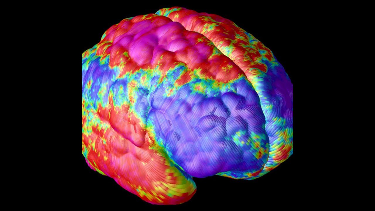 Schizophrenia simulator