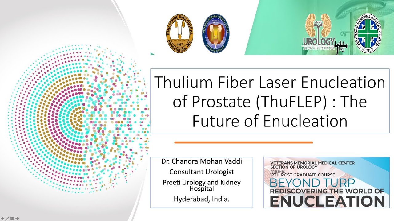 Thulium Fiber Laser Enucleation of Prostate (ThuFLEP) : The Future of Enucleation