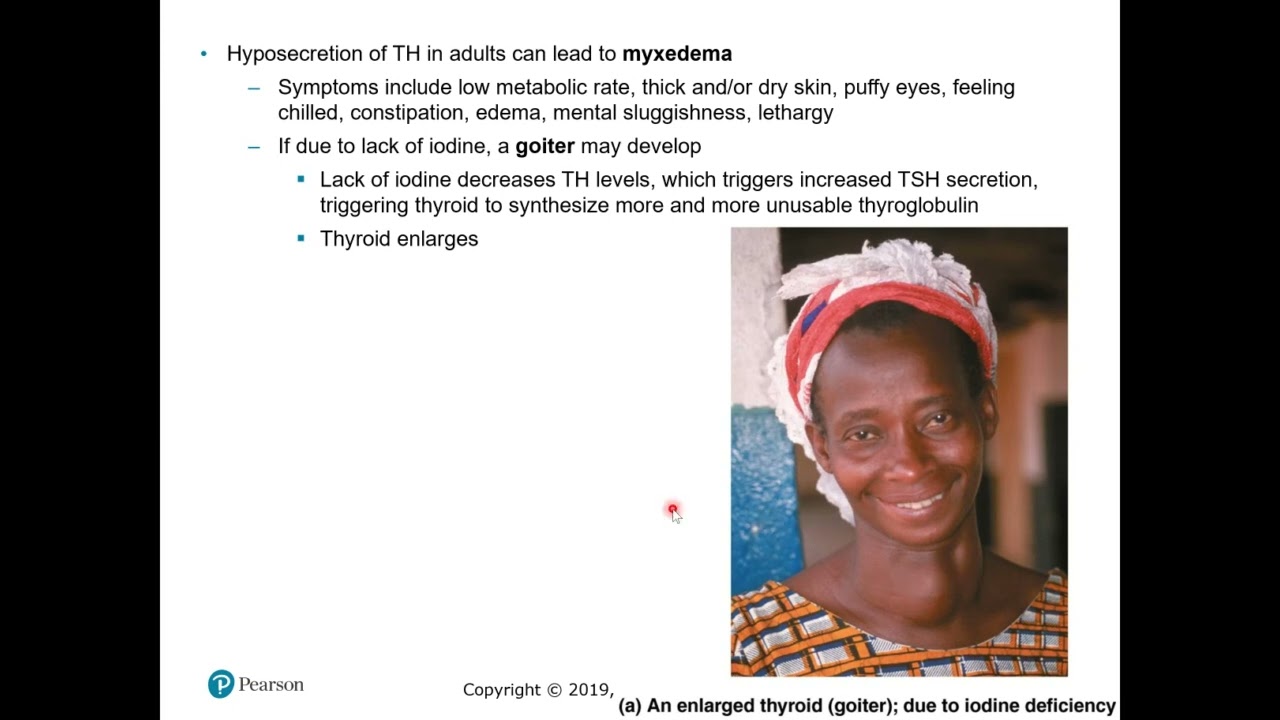 Ch 16 #10 Thyroid gland