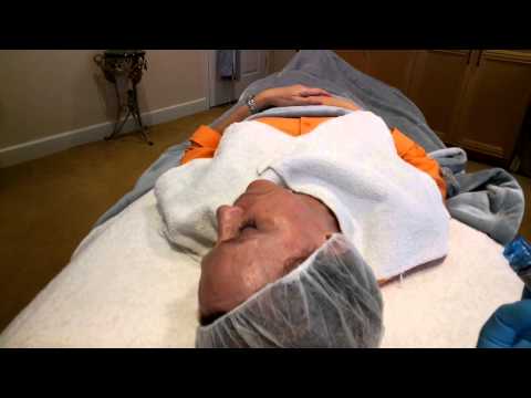 Hydrafacial on Google Glass at Holcomb - Kreithen Plastic Surgery