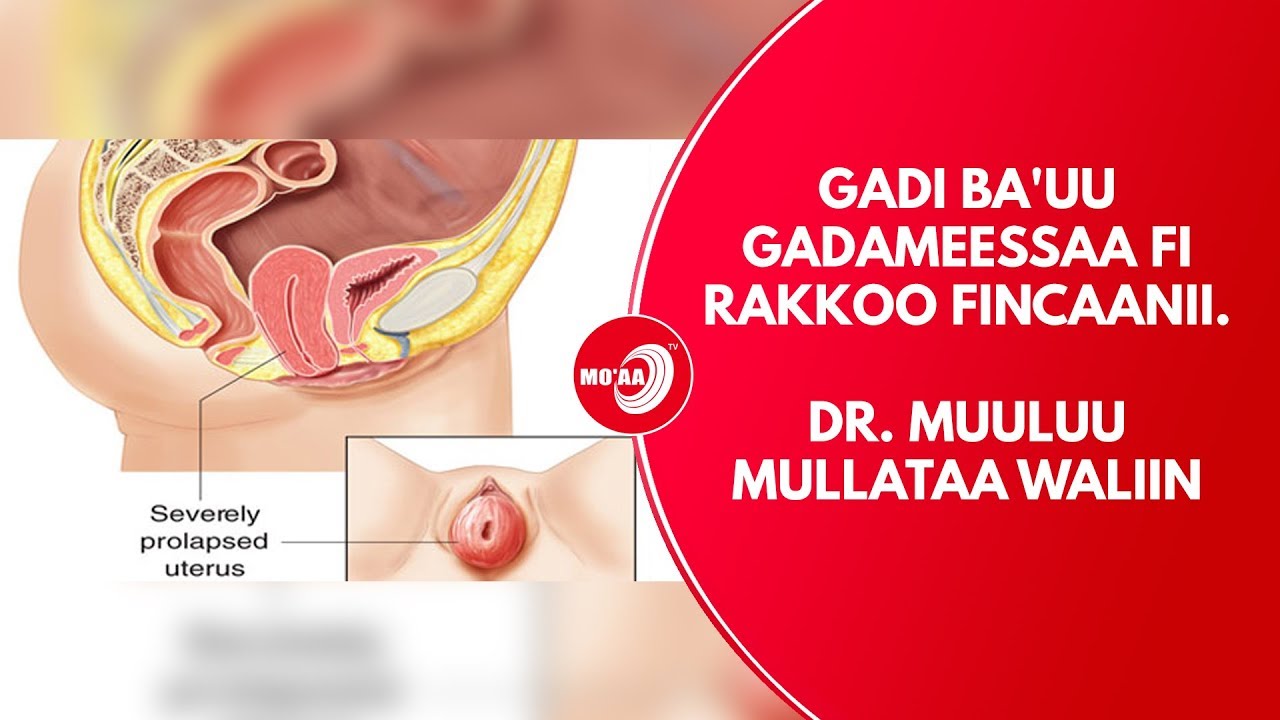 MO'AA TV Life show Ep 51 Gadi ba'uu gadameessaa fi Rakkoo fincaanii. Dr Muuluu Mullataa waliin