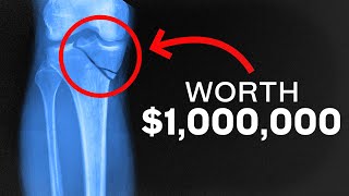 4 Surprising Injuries That May Pay You 1000000