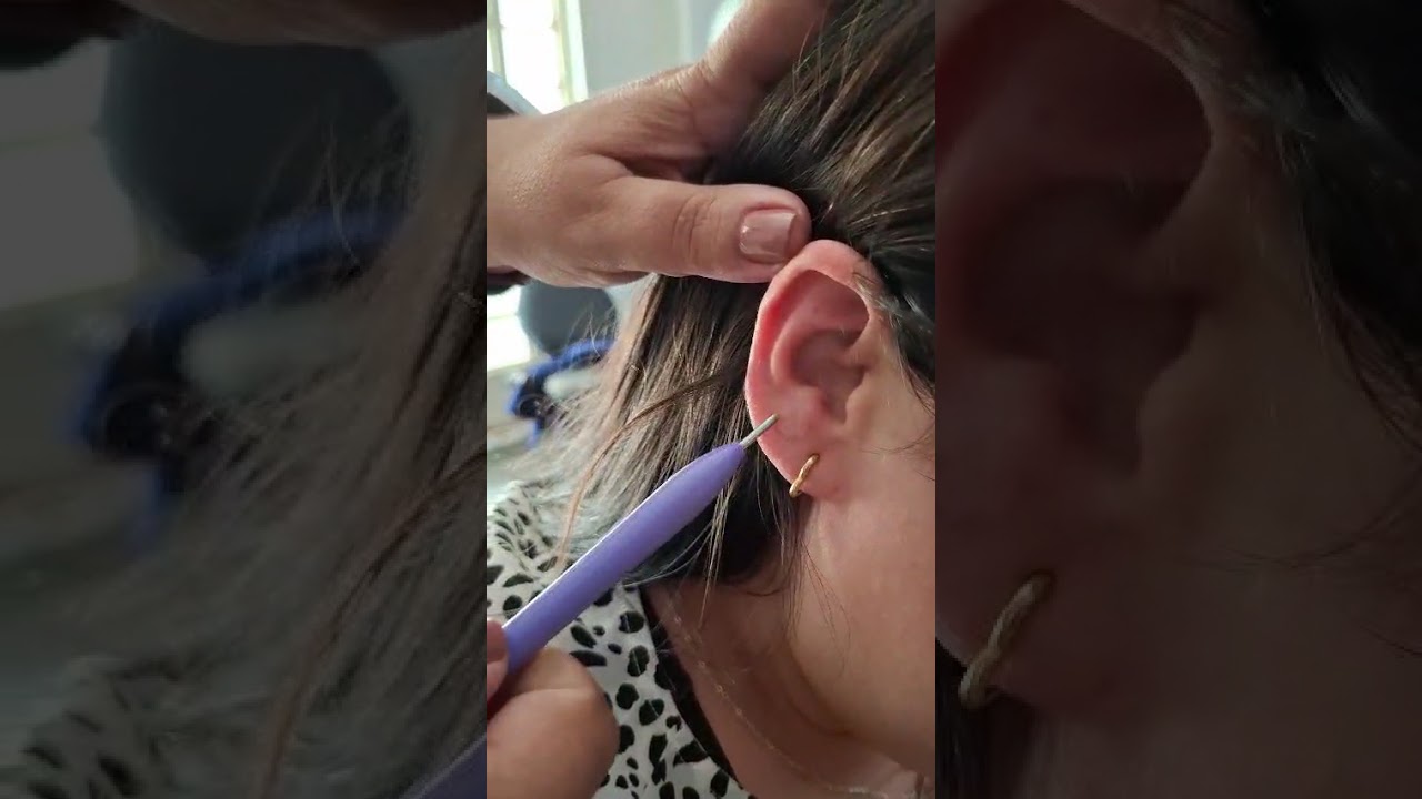 Prática de Diagnóstico na Auriculoterapia