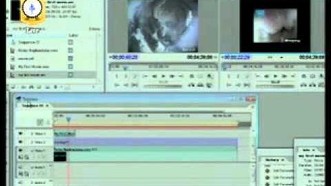 Dr R K Mishra delivering lecture on Laparoscopic Movie Making technique Part IV