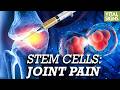 How Stem Cells, Exosomes, PRP Combat Arthritis? Why Adult Stem Cells Are More Ethical Than Embryonic