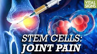 How Stem Cells, Exosomes, PRP Combat Arthritis? Why Adult Stem Cells Are More Ethical Than Embryonic