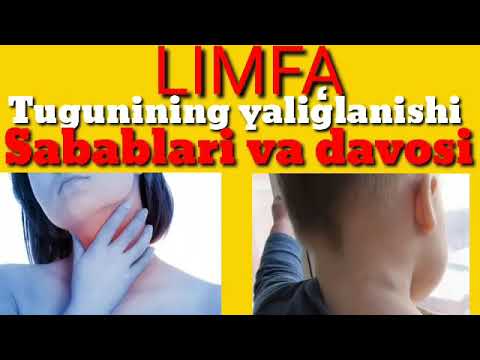 Video: Limfa Nima?