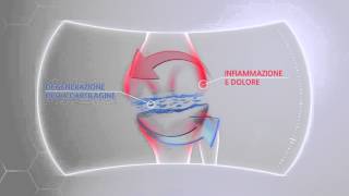 Dolori articolari, artrosi. Di cosa si tratta?