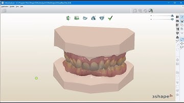 Study Model Virtual Base Preparation in 3Shape