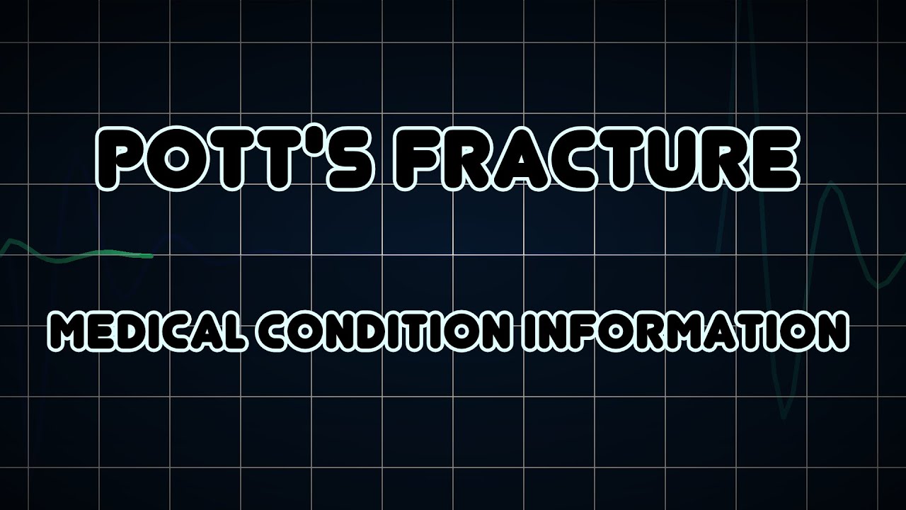 pott s fracture