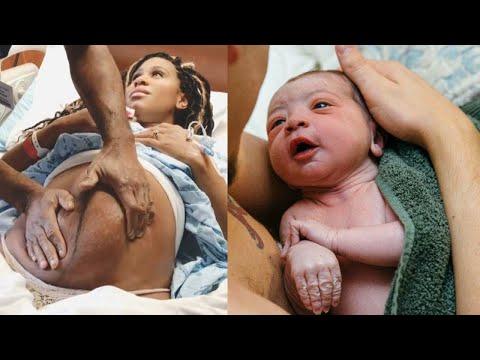 Doctor Turns Breech Baby Still in Mother's Belly