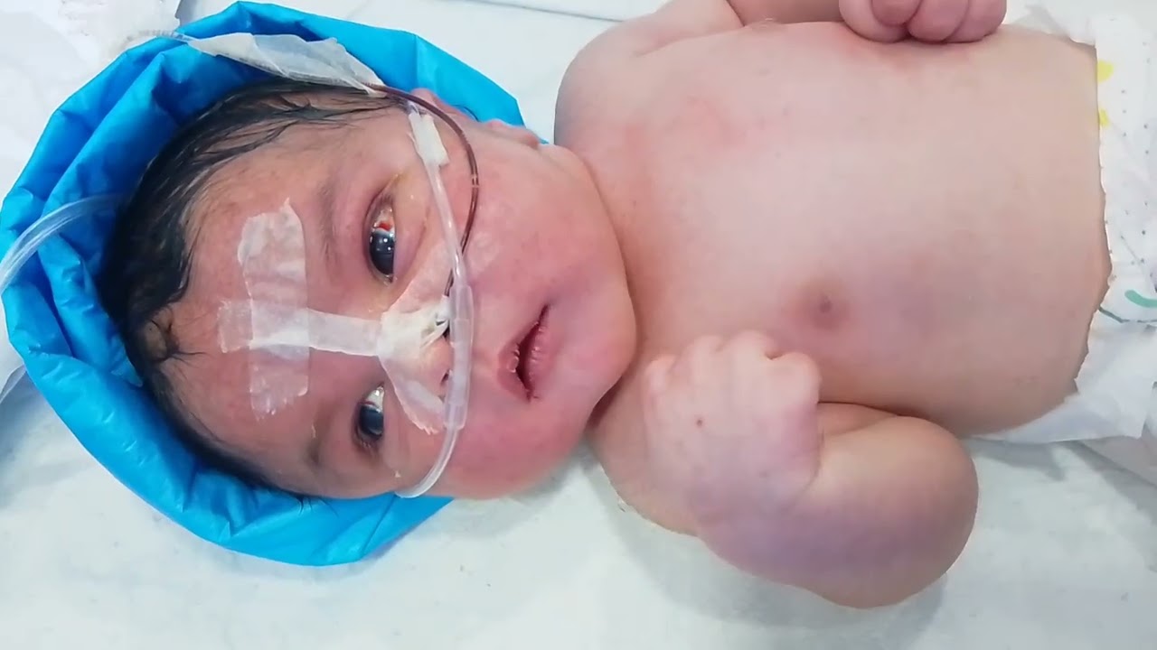  Recovery from Birth Asphyxia | 3rd Day Oxygen Dependent Baby Now Stable | RN Minhaj Khan NICU Care"