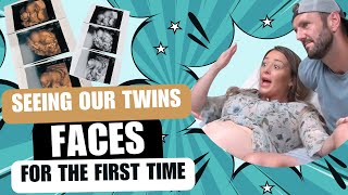 17 WEEK ULTRASOUND: Seeing our Twins' Faces for the *FIRST TIME* in 4D! #pregnancy #ultrasound