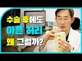 수술 후에도 허리는 왜 계속 아플까? 시/수술 후 허리 통증의 원인, 속 시원히 알려드립니다!