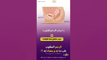 الرحم المقلوب طب ده أي ومعناه أى صحة توعية اوعى الحمل تأخر الحمل Health 