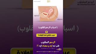 #الرحم المقلوب طب ده أي ومعناه أى ؟#صحة #توعية #اوعى #الحمل #تأخر_الحمل #health