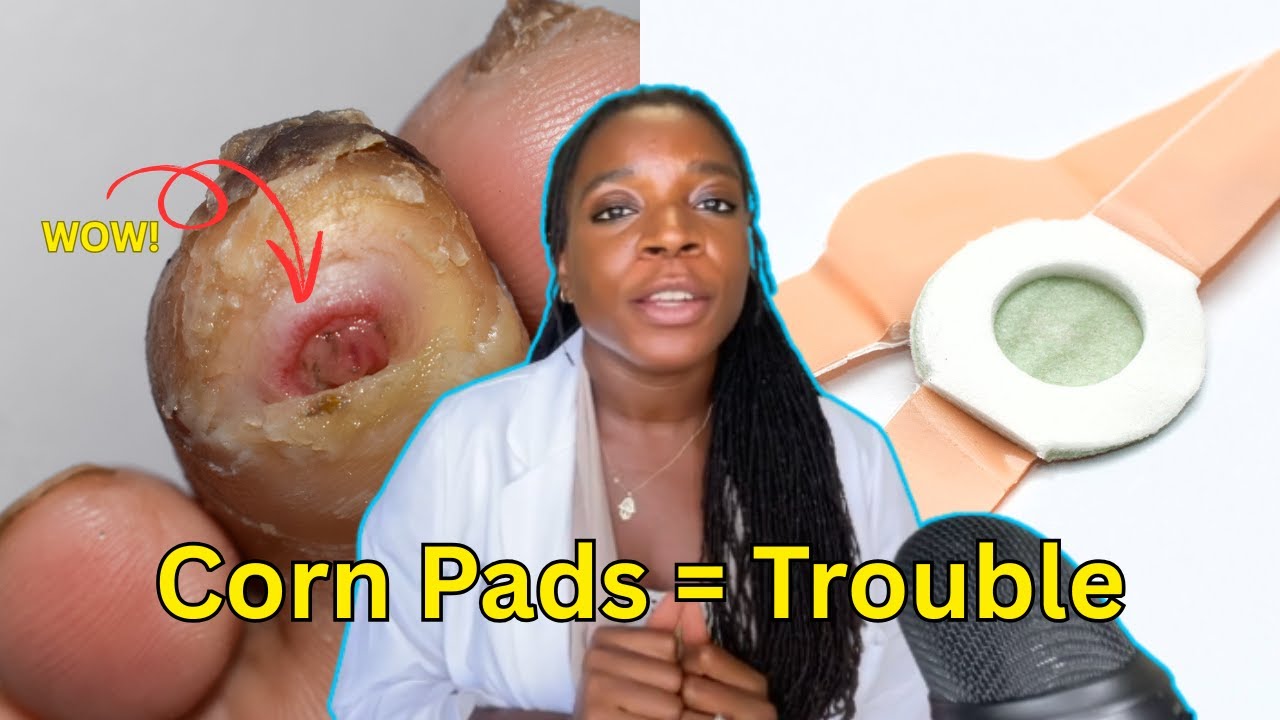 Plantar Wart Removal at Home: What Works (and What to Avoid)