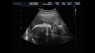 видео 27 неделя беременности