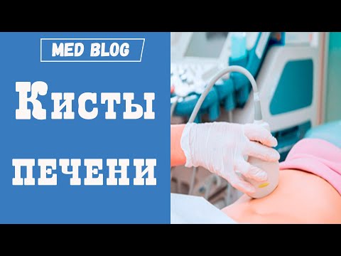 Киста печени | Что делать? | Нужна ли операция | Как правильно наблюдать за кистой печени?