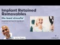 Dental Treatment: Implant Retained Overdentures | Nov 21, 2022