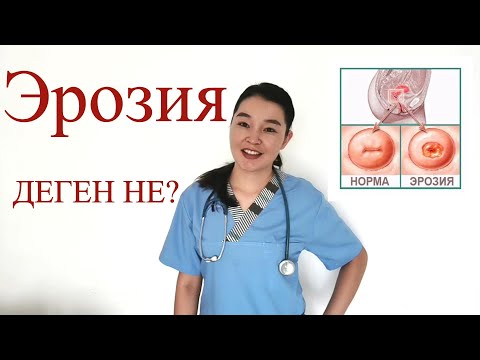 Бейне: Неліктен овуляциядан кейін жатыр мойнының кілегейлі шырышы пайда болады?