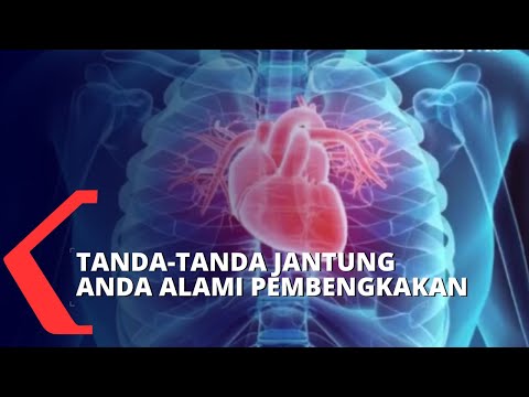 Video: Apa yang dimaksud dengan bengkak?