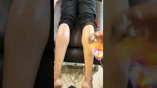 backpain hijamacuppingtherapy backpainchiropractor cuppingtherapy backpainrelief cervicalpain