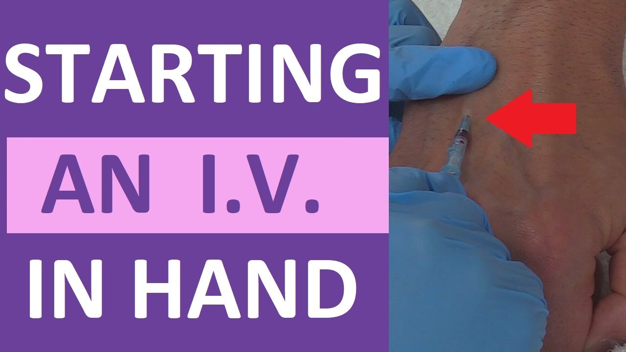 How to Start an IV | IV Catheter Insertion & Flush Technique in Hand | Nursing Skill