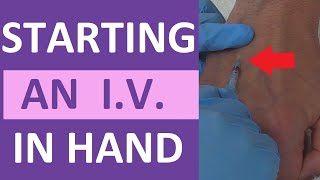 How To Start An Iv Iv Catheter Insertion Flush Technique In Hand Nursing Skill